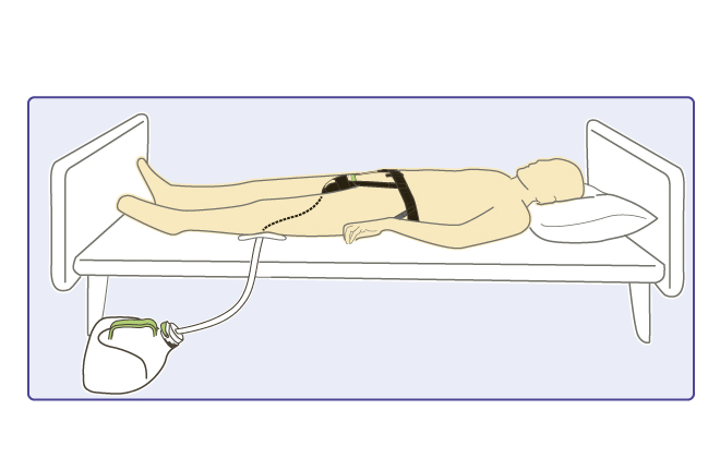 For those who want to be able to urinate in a sleeping position.